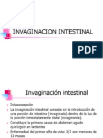 Invaginacion Intestinal