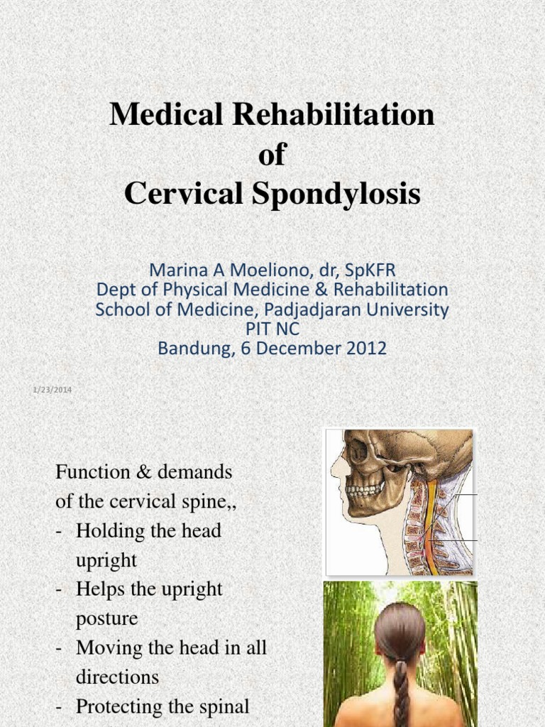 Cervical Spondylosis Pdf Vertebral Column Vertebra