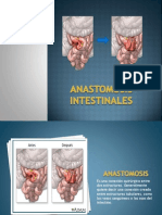 Anastomosis Intestinales