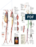 Aneurisma Aorta