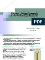 28511673 Fractura de Diafiza Humerala