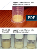 Appearances of Human Milk Bright Yellow Colostrum
