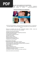 ANÁLISE DAS MARCAS DE MORDIDA