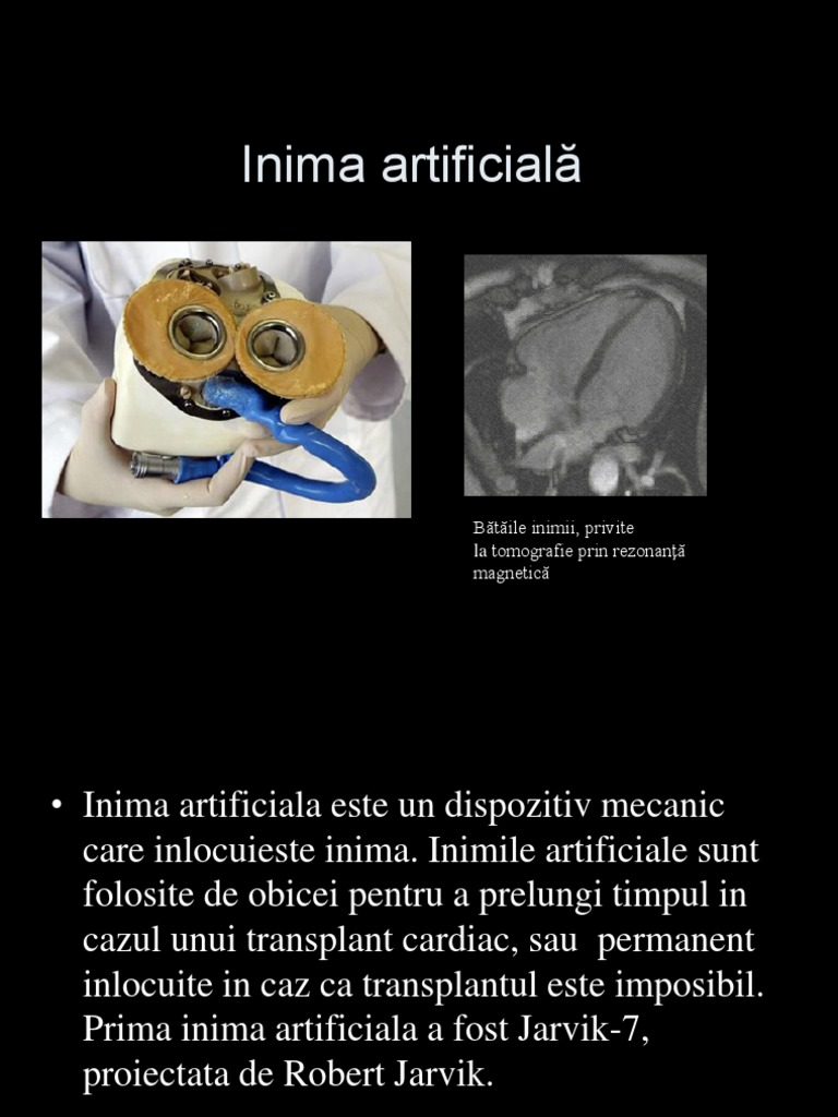 Inima Arificială | PDF