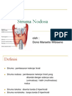 Struma Nodosa