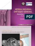 hernia-inguinal (1).ppt