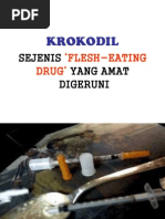 Kesan Dadah Krokodil