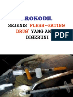 Kesan Dadah Krokodil