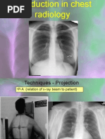 Chest X-Ray Anatomy and Positioning Guide | PDF | Thorax | Lung