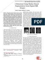 Brain Tumor Detection Using Marker Based Watershed Segmentation From Digital MR Images