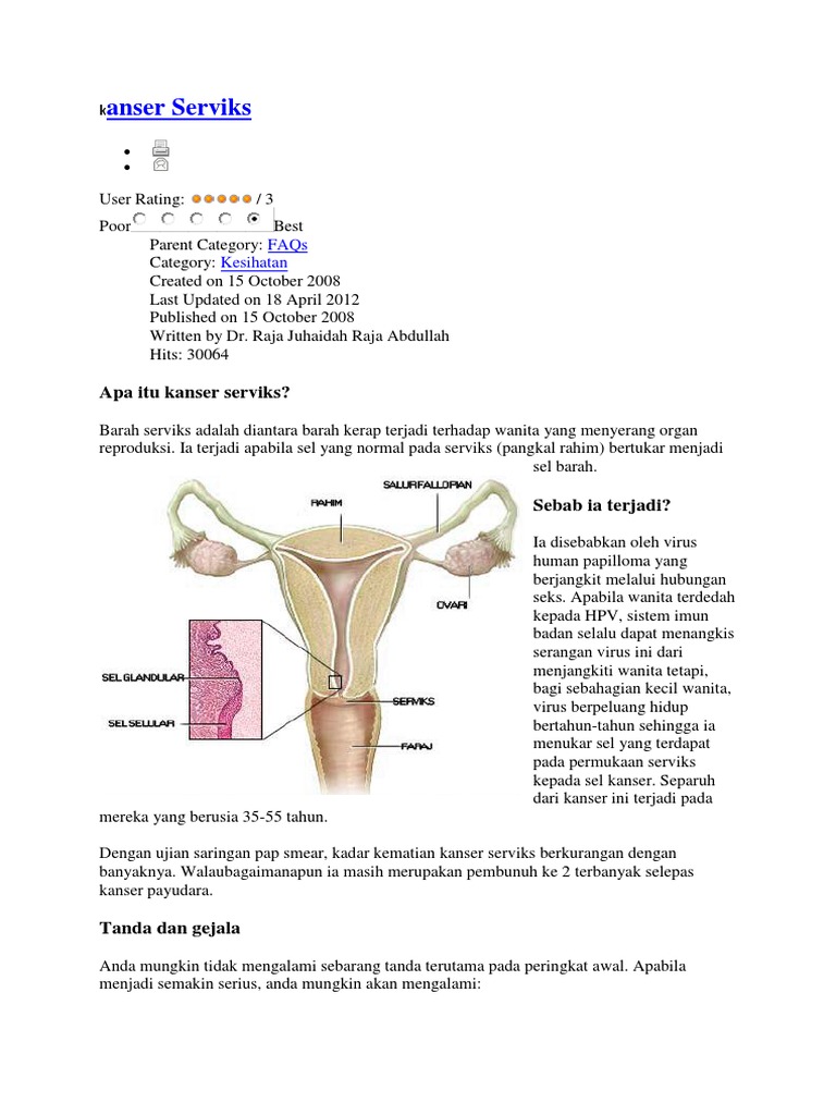 Kanser Serviks  PDF