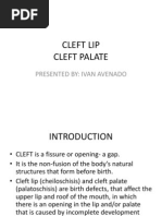 Cleft Lip Cleft Palate: Presented By: Ivan Avenado