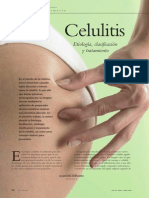Celulitis: Etiología, Clasificación y Tratamiento