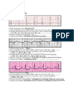 ECG Rhythm Strip Analysis