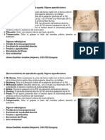 Apendicitis