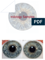 Iridology Samples 2