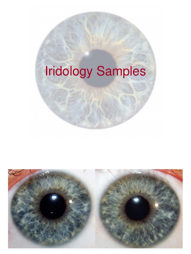 Iridology Sample Analysis Guide | PDF