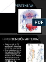 Crisis Hipertensiva