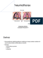 Pneumothorak Print