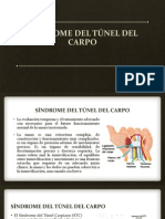 Síndrome Del Túnel Del Carpo