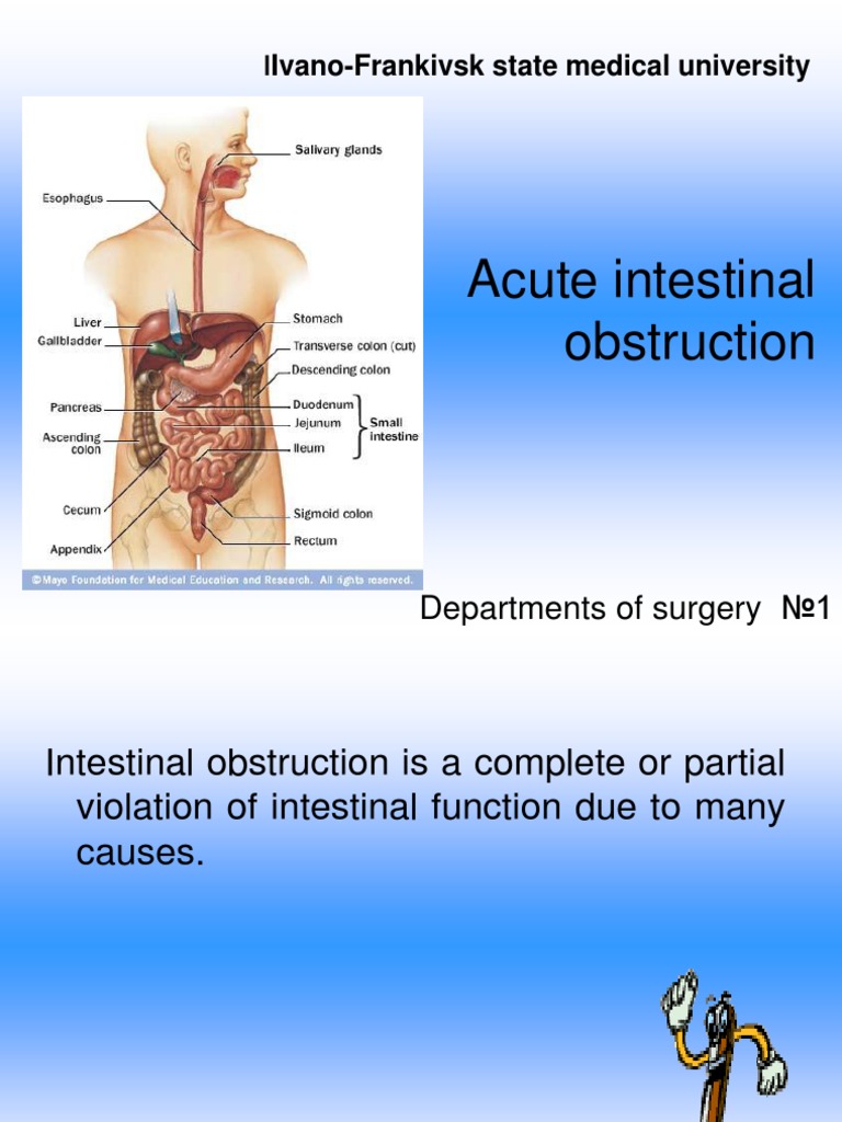 Acute Intestinal Obstruction... PDF Gastrointestinal Tract