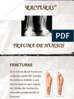 FRACTURAS - SEMINARIO.pptx