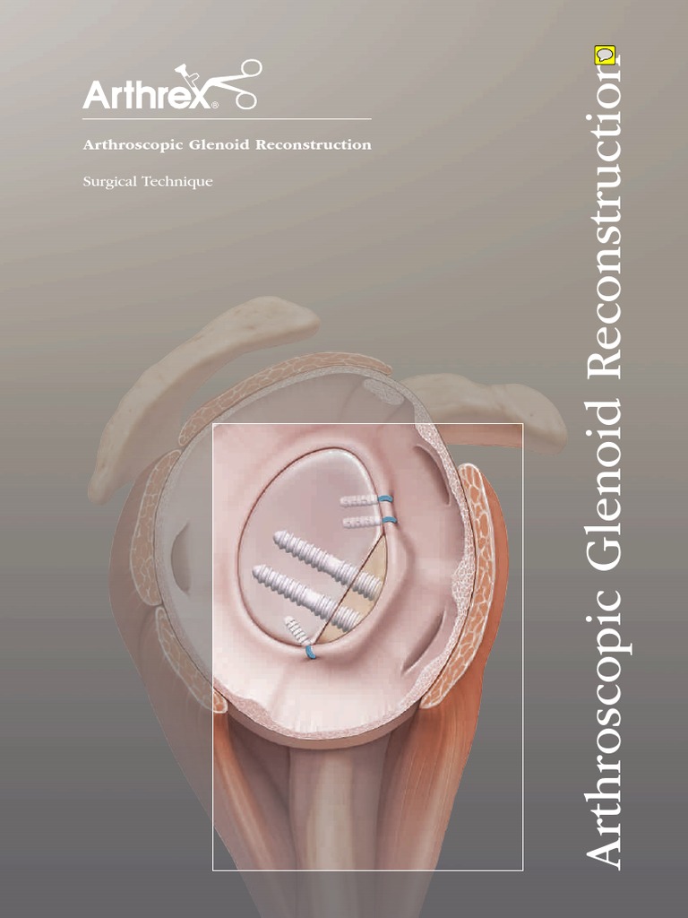 Arthroscopic Glenoid Reconstruction | PDF | Anatomical Terms Of ...