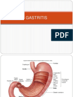 Gastritis