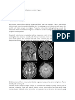 Glioma klasifikasi dan patologi