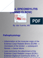Lateral Epicondylitis (Tennis Elbow) : By:Ida Yuanita, MD