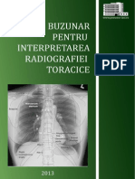 Ghid de Buzunar Pentru Interpretarea Radiografiei Toracice