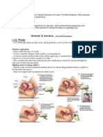 Methods of Abortion 12 Weeks: Suction Aspiration