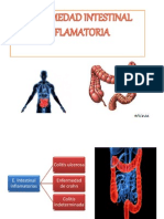 Enfermedad de Crohn