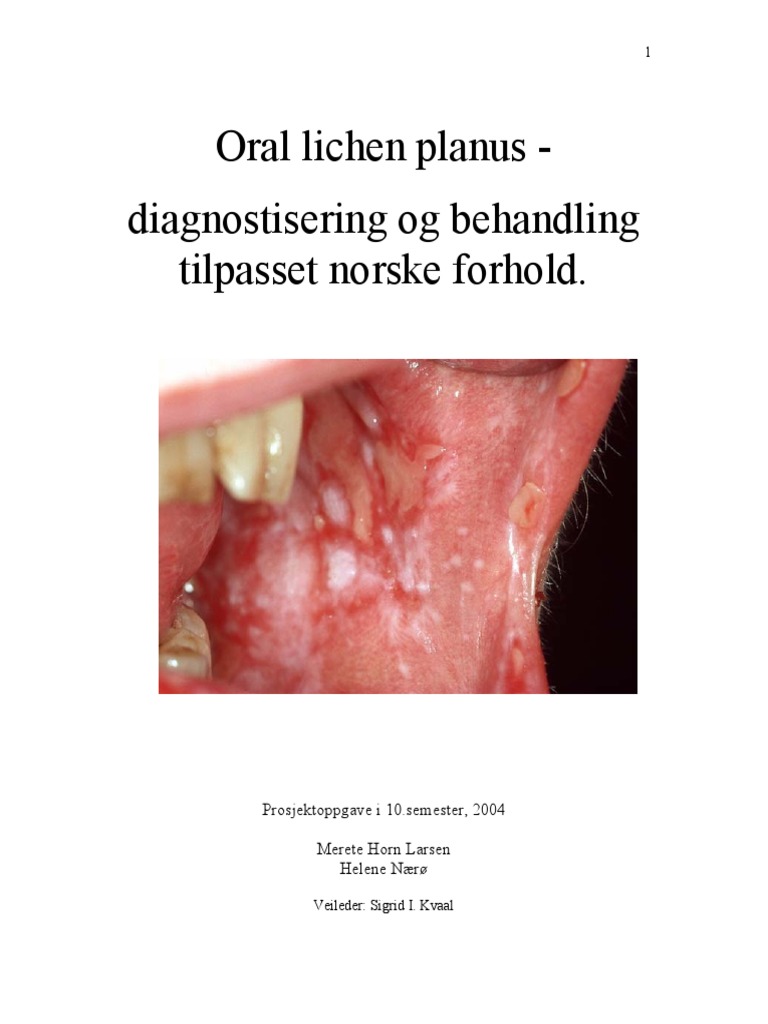 Pathology Outlines - Pseudoepitheliomatous hyperplasia, image size:768x1024