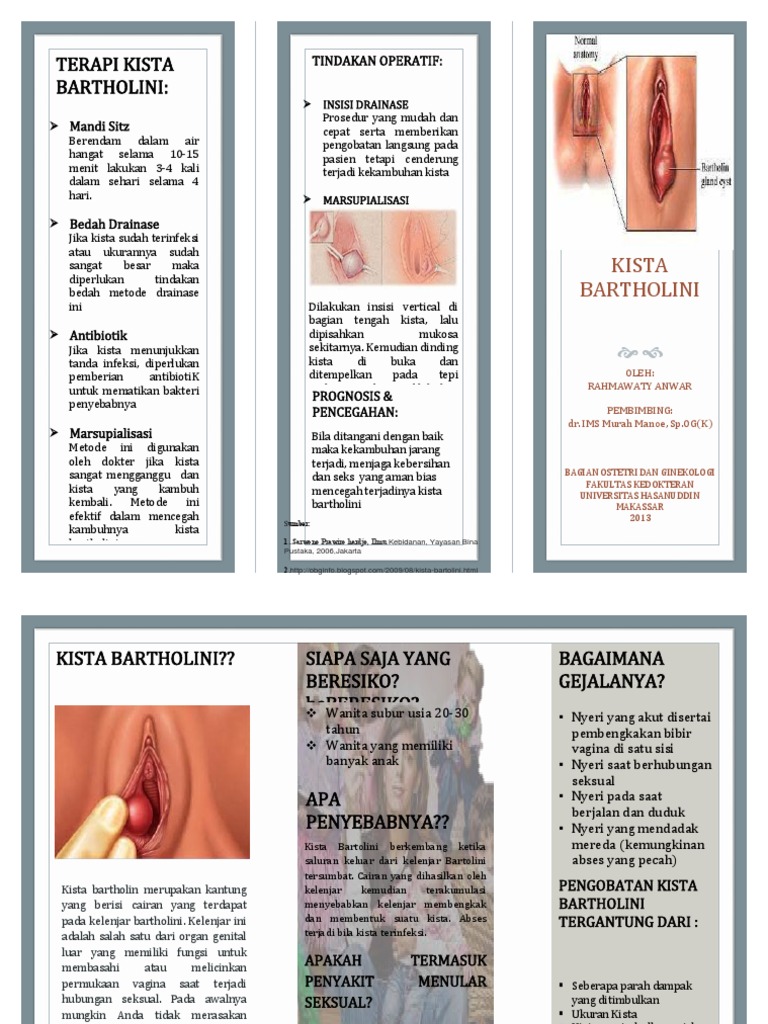 Kista Bartholin New Docx