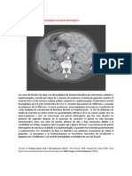 A primera vista 435 (Esplenomegalia con patrón heterogéneo).docx