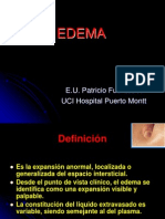 Edema Uss