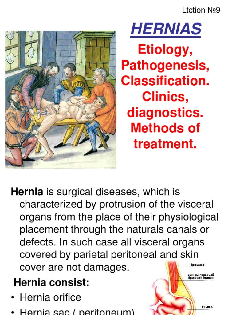 Hernias | PDF | Abdomen | Clinical Medicine