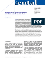 Rehabilitacion Oral en Un PX Removible PDF