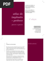 Atlas Protese Sobre Implante