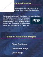 Panoramic Anatomy: The Following Slides Identify The Anatomical Structures Found On Panoramic Radiographs