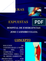 Fracturas Expuestas