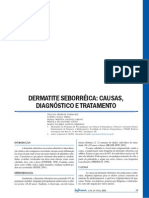 Dermatite Seborréica: Causas e Tratamento