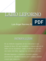 Labio Leporino