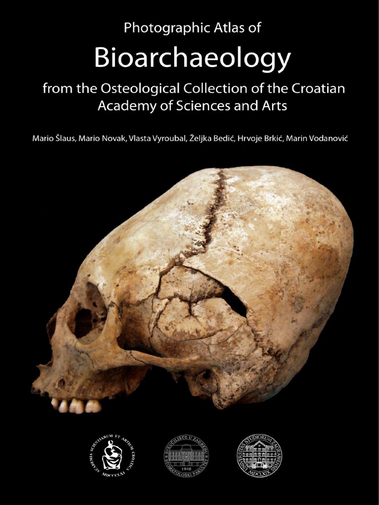 Photographic Atlas of Bioarchaeology From The Osteological Collection ...