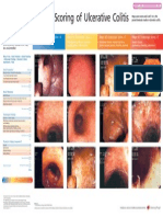 Mayo Endoscopic Scoring of Ulcerative Colitis