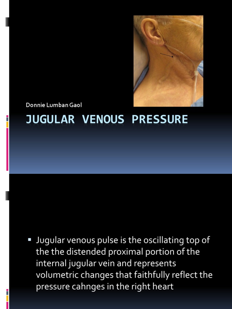 Understanding Jugular Venous Pressure | PDF | Atrium (Heart) | Vein