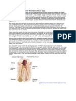 Root Canal Treatment