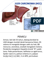 Hepatoceluler Carcinoma (HCC)