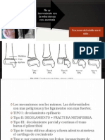 Tratamiento Trauma Fracturas